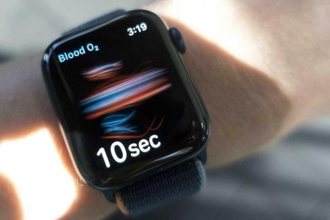 Série Apple Watch 